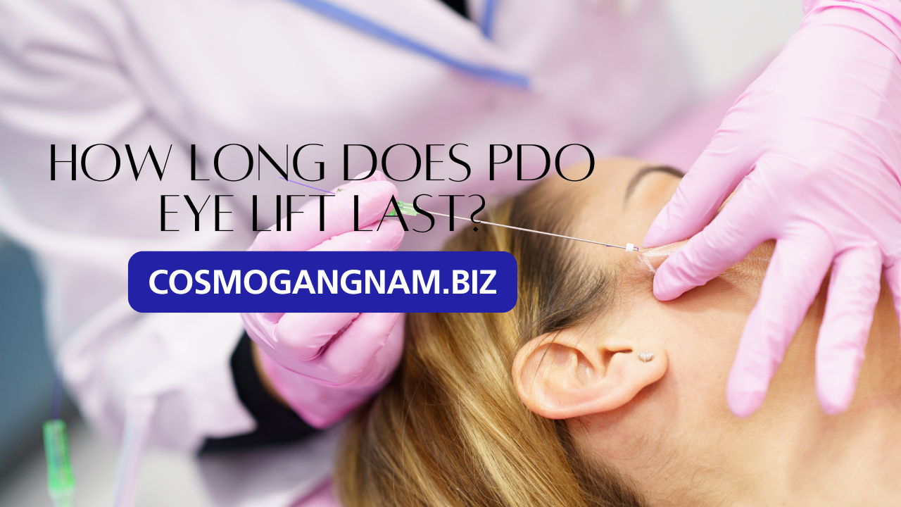 How Long Does PDO Eye Lift Last?