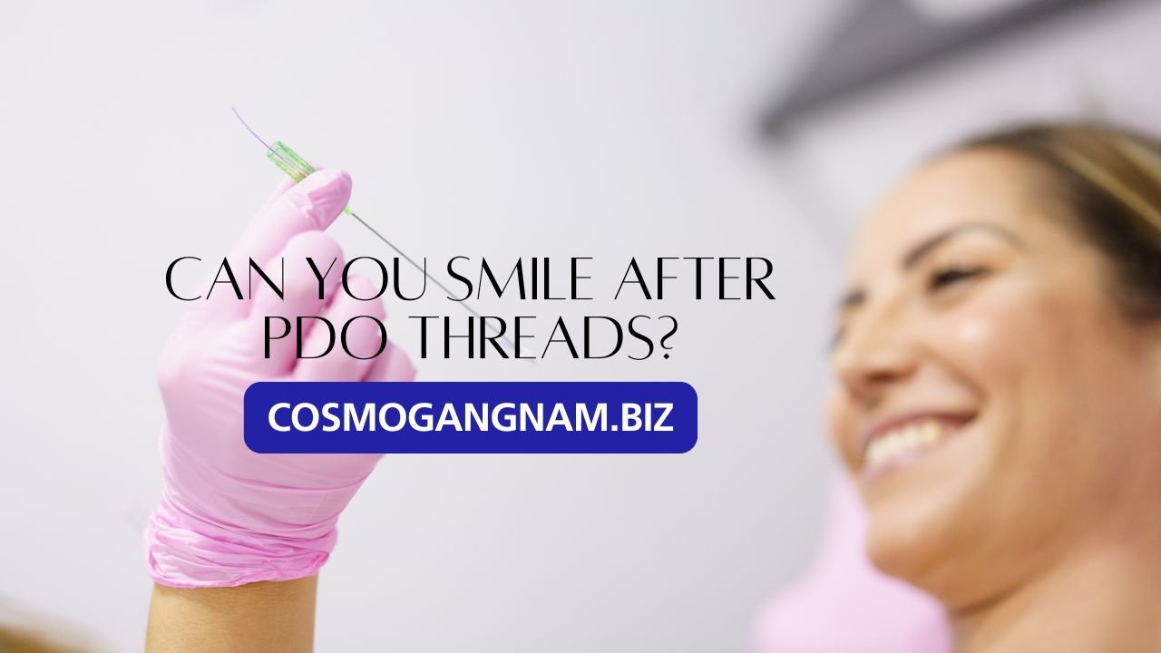 Can You Smile After PDO Threads?