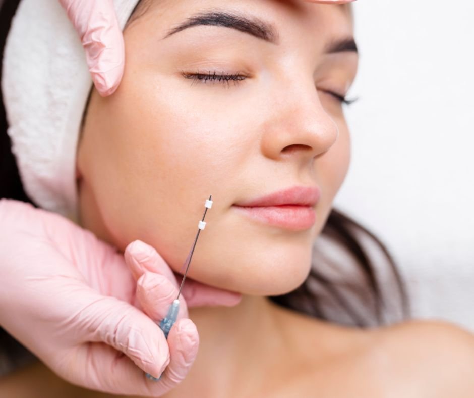 PDO Threads Under the Eye - procedure
