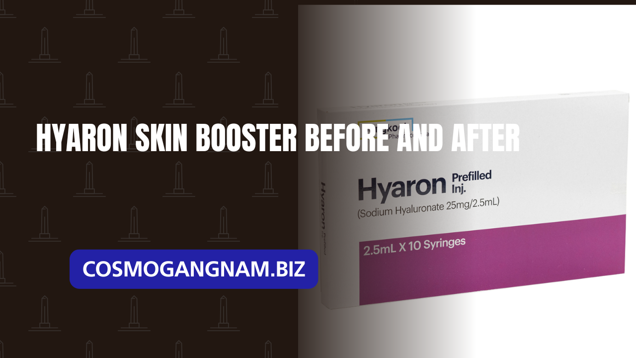 Hyaron skin booster before and after